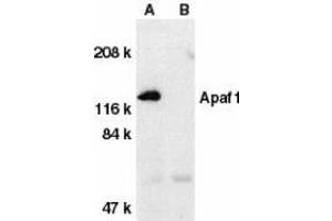 Western blot analysis of Apaf1 in human heart tissue lysate with Apaf1 (CT) antibody at 1μg/ml in the absence (A) or presence (B) of blocking peptide.
