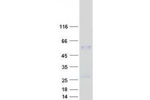Pregnancy Specific beta-1-Glycoprotein 3 (PSG3) protein (Myc-DYKDDDDK Tag)