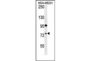 Western blot analysis of HFM1 Antibody (C-term) in MDA-MB231 cell line lysates (35ug/lane). (HFM1 antibody  (C-Term))