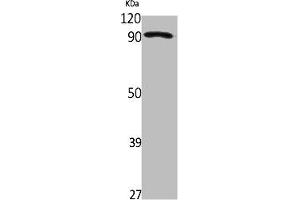 Western Blot analysis of Jurkat cells using ZNF227 Polyclonal Antibody (ZNF227 antibody  (Internal Region))
