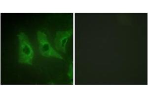 Immunofluorescence analysis of HeLa cells, using CKI-alpha (Ab-321) Antibody. (CSNK1A1 antibody  (AA 287-336))