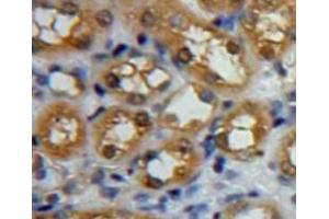 Used in DAB staining on fromalin fixed paraffin-embedded kidney tissue (CAPN1 antibody  (AA 185-356))