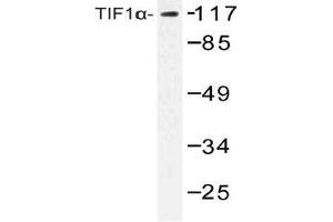Western blot (WB) analysis of TIF1alpha antibody in extracts from COLO cells.
