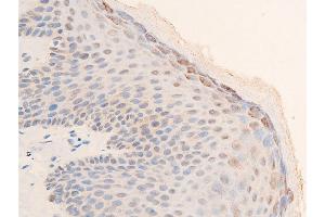 Immunohistochemistry (IHC) image for anti-Checkpoint Kinase 2 (CHEK2) (pThr68) antibody (ABIN6256592)