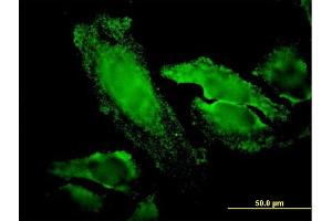 Immunofluorescence of monoclonal antibody to RPS7 on HeLa cell. (RPS7 antibody  (AA 95-194))