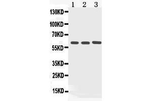Western blot analysis of Cytokeratin 5 expression in rat kidney extract ( Lane 1), COLO320 whole cell lysates ( Lane 2) and HELA whole cell lysates ( Lane 3). (Cytokeratin 5 antibody  (Middle Region))