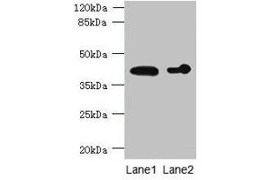 Western blot All lanes: ASPHD2 antibody at 4 μg/mL Lane 1: Hela whole cell lysate Lane 2: HL60 whole cell lysate Secondary Goat polyclonal to rabbit IgG at 1/10000 dilution Predicted band size: 42 kDa Observed band size: 42 kDa
