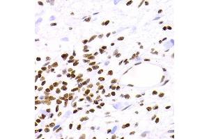 Immunohistochemistry (Paraffin-embedded Sections) (IHC (p)) image for anti-Nuclear Factor of kappa Light Polypeptide Gene Enhancer in B-Cells 2 (NFKB2) (AA 690-899) antibody (ABIN3017388)
