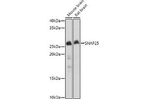 Western blot analysis of extracts of various cell lines, using SN antibody (ABIN3021231, ABIN3021232, ABIN3021233 and ABIN6214078) at 1:1000 dilution.