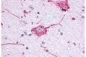 Anti-OPRM1 / Mu Opioid Receptor antibody  ABIN1049170 IHC staining of human brain, neuron. (Mu Opioid Receptor 1 antibody  (Extracellular Domain))