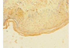 Immunohistochemistry of paraffin-embedded human skin tissue using ABIN7144737 at dilution of 1:100 (ASPHD1 antibody  (AA 96-390))