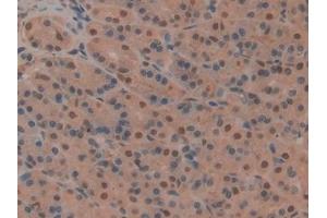 Detection of CD2AP in Rat Stomach Tissue using Polyclonal Antibody to CD2 Associated Protein (CD2AP) (CD2AP antibody  (AA 368-623))