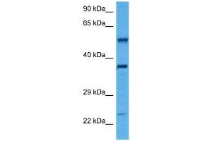 Host:  Rabbit  Target Name:  SMAD1  Sample Tissue:  Mouse Kidney  Antibody Dilution:  1ug/ml (SMAD1 antibody  (Middle Region))