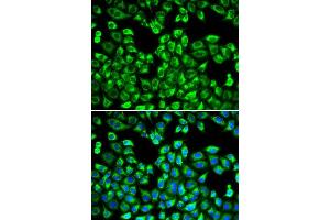 Immunofluorescence analysis of MCF-7 cell using PSMC2 antibody. (PSMC2 antibody  (AA 1-160))