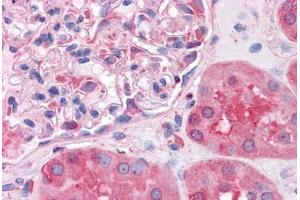 Human Kidney: Formalin-Fixed, Paraffin-Embedded (FFPE) (SHMT1 antibody  (AA 374-483))