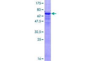 ACTC1 Protein (AA 1-377) (GST tag)