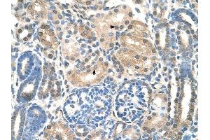 UBE2E2 antibody was used for immunohistochemistry at a concentration of 4-8 ug/ml to stain EpitheliaI cells of renal tubule (arrows) in Human Kidney. (UBE2E2 antibody)