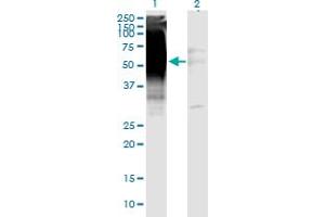 Western Blot analysis of GDF5 expression in transfected 293T cell line by GDF5 monoclonal antibody (M06), clone 1F4. (GDF5 antibody  (AA 28-127))