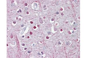Anti-CNP antibody IHC of human brain, cortex. (Cnpase antibody  (C-Term))