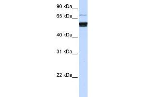 WB Suggested Anti-ZNF93 Antibody Titration:  0. (ZNF93 antibody  (N-Term))