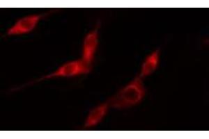ABIN6274148 staining HeLa cells by IF/ICC. (TK1 antibody  (N-Term))