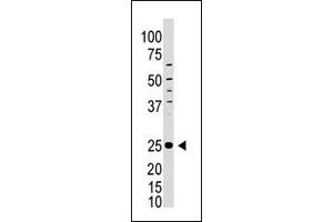 Image no. 1 for anti-Inducible T-Cell Co-Stimulator (ICOS) (C-Term) antibody (ABIN358624) (ICOS antibody  (C-Term))