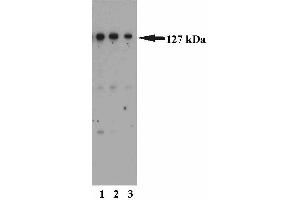 Western blot analysis of MSH3 on a HeLa cell lysate (Human cervical epitheloid carcinoma, ATCC CCL-2).