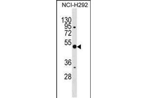 Western blot analysis in NCI-H292 cell line lysates (35ug/lane). (Annexin a10 antibody  (C-Term))