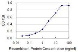 Detection limit for recombinant GST tagged DST is 0. (Dystonin antibody  (AA 401-500))