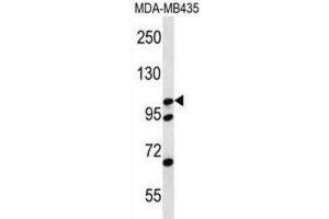 Western Blotting (WB) image for anti-Catenin (Cadherin-Associated Protein), delta 2 (Neural Plakophilin-Related Arm-Repeat Protein (CTNND2) antibody (ABIN2996812)