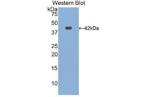 Western Blotting (WB) image for anti-Transferrin Receptor 2 (TFR2) (AA 4-87) antibody (ABIN1172689) (Transferrin Receptor 2 antibody  (AA 4-87))