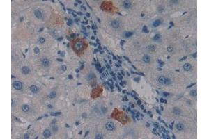 Detection of PSG1 in Human Liver Tissue using Polyclonal Antibody to Pregnancy Specific Beta-1-Glycoprotein 1 (PSG1) (PSG1 antibody  (AA 202-401))