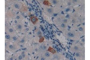 Detection of PSG1 in Human Liver Tissue using Polyclonal Antibody to Pregnancy Specific Beta-1-Glycoprotein 1 (PSG1)