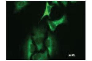 Immunostaining analysis in HeLa cells. (HARS1/Jo-1 antibody)
