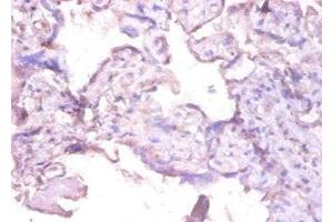 Immunohistochemistry of paraffin-embedded human placenta tissue using ABIN7156957 at dilution of 1:100 (MMP1 antibody  (AA 101-469))