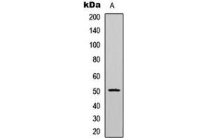 Western blot analysis of CaMK2 alpha/delta (pT286) expression in HeLa (A) whole cell lysates. (CaMK2 alpha/delta antibody  (pSer286))
