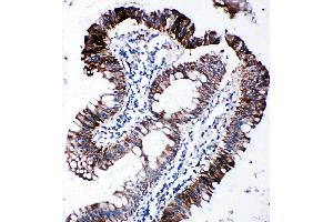 Immunohistochemistry (IHC) image for anti-Eukaryotic Translation Initiation Factor 2 Subunit 1 (EIF2S1) (AA 123-137), (Middle Region) antibody (ABIN3044058)