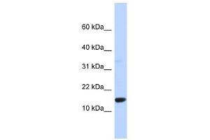 TPD52L3 antibody used at 1 ug/ml to detect target protein. (TPD52L3 antibody  (Middle Region))