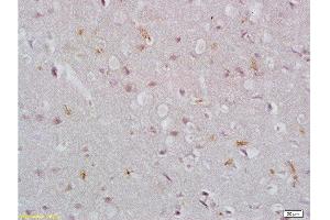 Immunohistochemistry (Paraffin-embedded Sections) (IHC (p)) image for anti-Epithelial Cell Adhesion Molecule (EPCAM) (AA 53-150) antibody (ABIN670611)