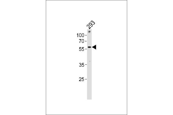 ZNF76 antibody  (C-Term)