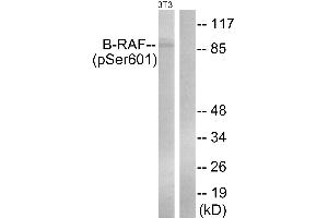 Immunohistochemistry analysis of paraffin-embedded human placenta tissue using B-Raf (Phospho-Ser602) antibody. (SNRPE antibody  (pSer602))