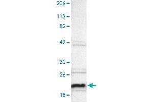 Western blot analysis of Human cell line RT-4 with ALG13 polyclonal antibody . (ALG13 antibody)