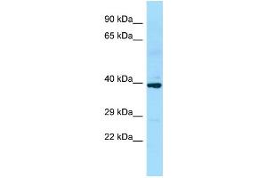 WB Suggested Anti-SLC35D2 Antibody Titration: 1. (Solute Carrier Family 35 (UDP-GlcNAc/UDP-Glucose Transporter), Member D2 (SLC35D2) (C-Term) antibody)