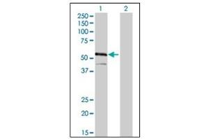 Western Blotting (WB) image for anti-Interferon Regulatory Factor 4 (IRF4) (AA 342-452) antibody (ABIN614626) (IRF4 antibody  (AA 342-452))