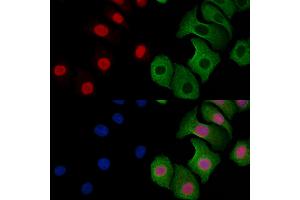 ABIN6257869 and ABIN6273599 staining Hela cells by IF/ICC.
