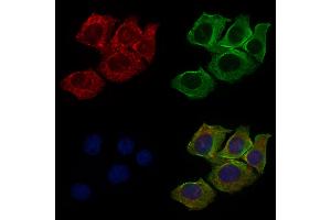 ABIN6265513 and ABIN6276479 staining HepG2 cells by IF/ICC. (TDGF1 antibody  (Internal Region))