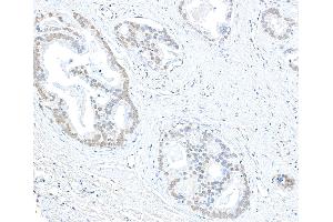 anti-Euchromatic Histone-Lysine N-Methyltransferase 1 (EHMT1) (AA 25-75) antibody