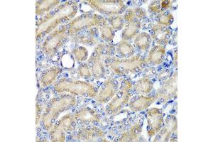 Immunohistochemistry of paraffin-embedded rat kidney using PDCD6 antibody at dilution of 1:200 (40x lens). (PDCD6 antibody)