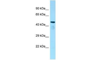 WB Suggested Anti-Atat1 Antibody Titration: 1. (Chromosome 6 Open Reading Frame 134 (C6orf134) (Middle Region) antibody)
