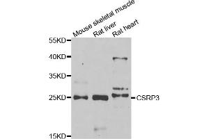 Western blot analysis of extracts of various cell lines, using CSRP3 antibody. (CSRP3 antibody)